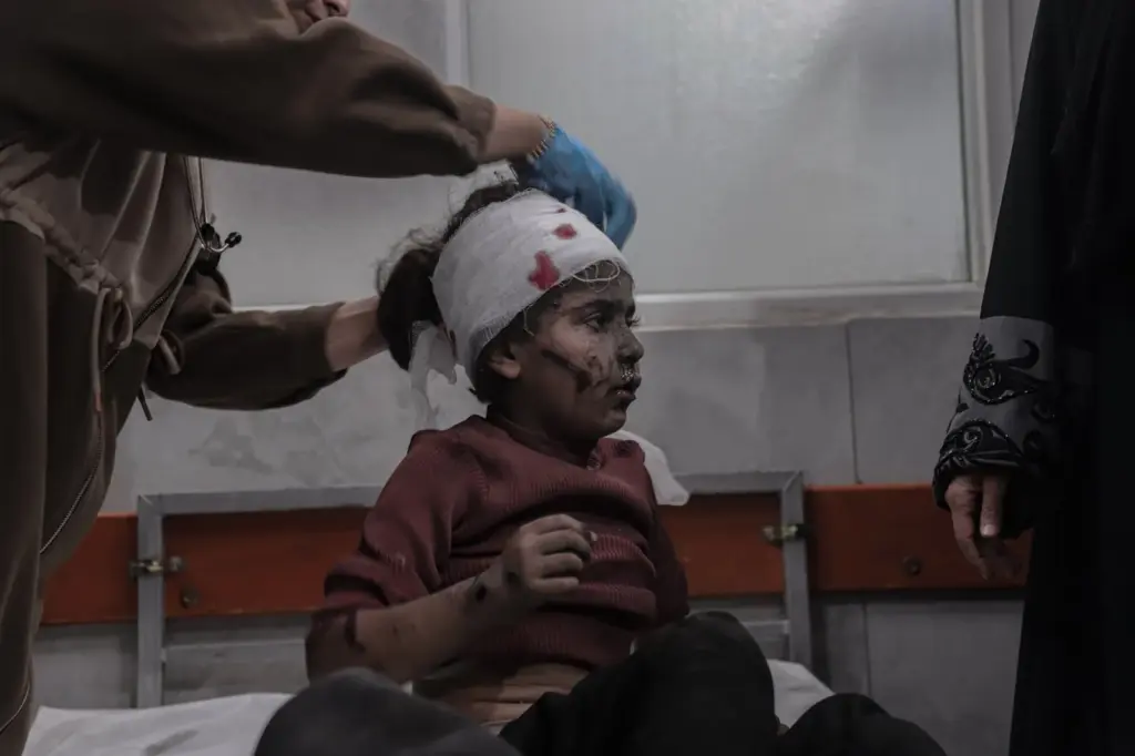 Almost half of those injured by bullets and shrapnel in the head in Gaza are minors