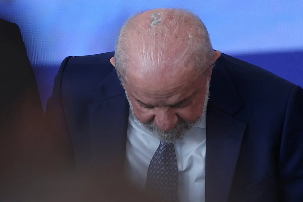 Lula recibe radioterapia preventiva contra el cáncer de piel a cuatro meses de las elecciones en Brasil
