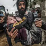 Almost half of those injured by bullets and shrapnel in the head in Gaza are minors