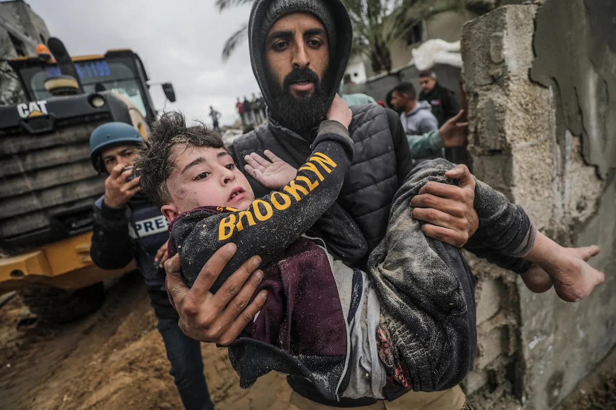 Almost half of those injured by bullets and shrapnel in the head in Gaza are minors