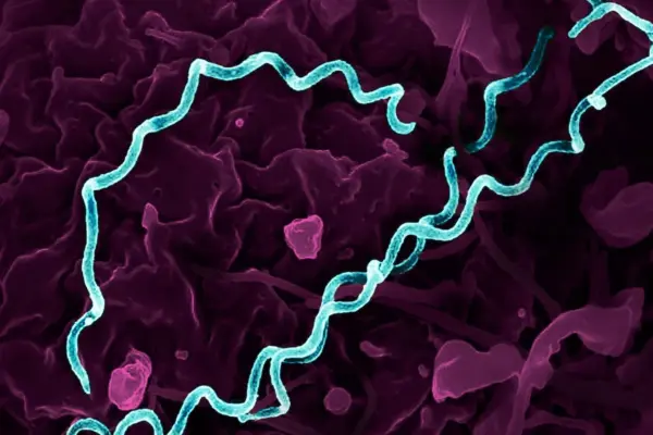 Sexually transmitted infections reach record levels across Europe