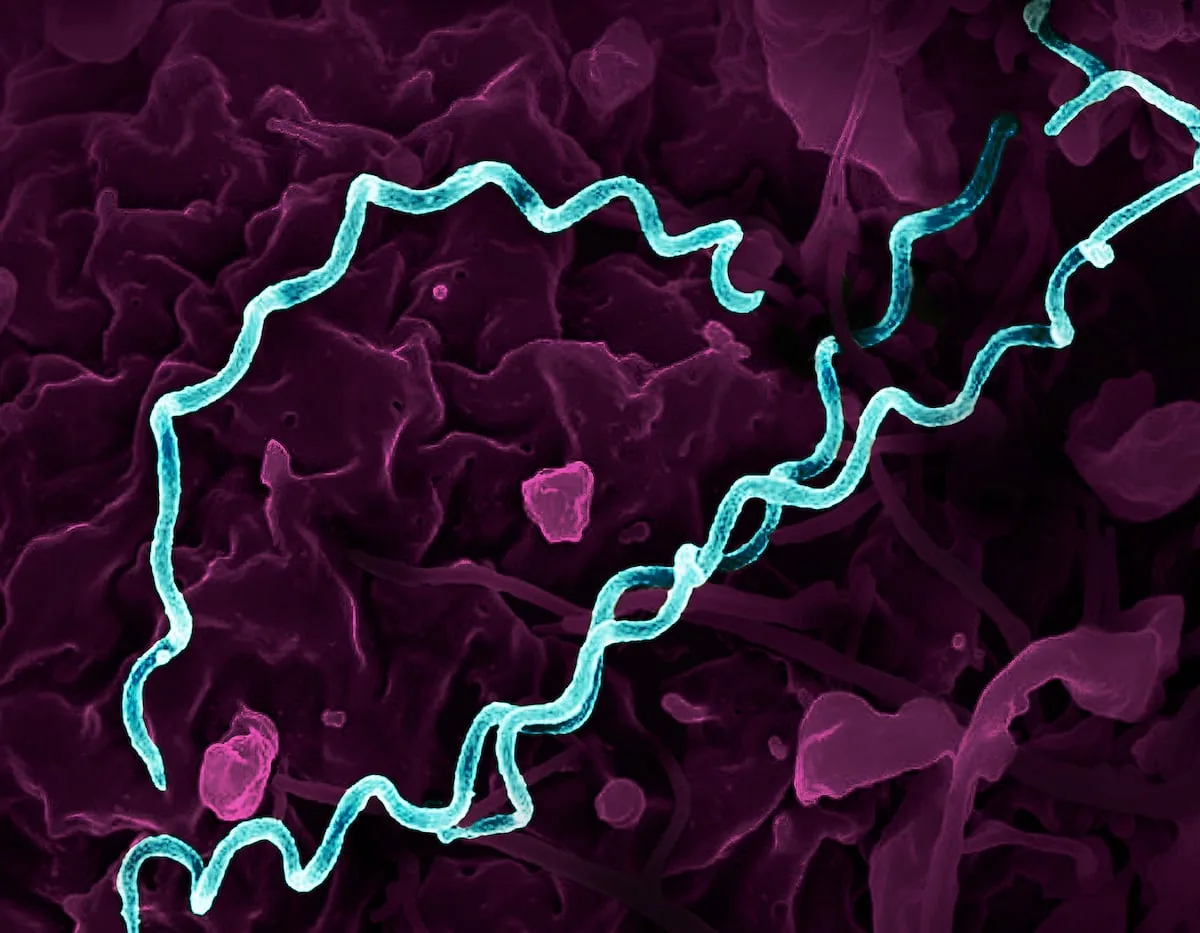 Sexually transmitted infections reach record levels across Europe