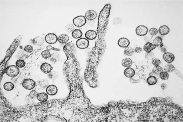 Así es el virus de los Andes, la única cepa de hantavirus que se transmite de persona a persona