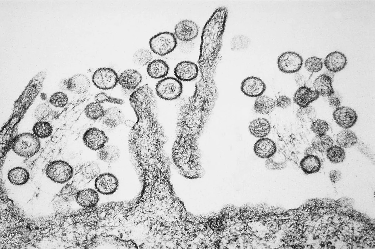 Así es el virus de los Andes, la única cepa de hantavirus que se transmite de persona a persona