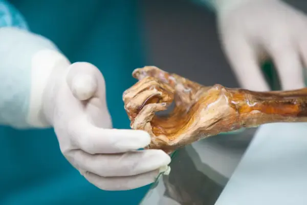 The microbes of Ötzi, the Iceman, awaken thousands of years after his death