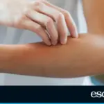 The easy-to-apply natural roll-on repellent that helps protect the whole family from mosquitoes