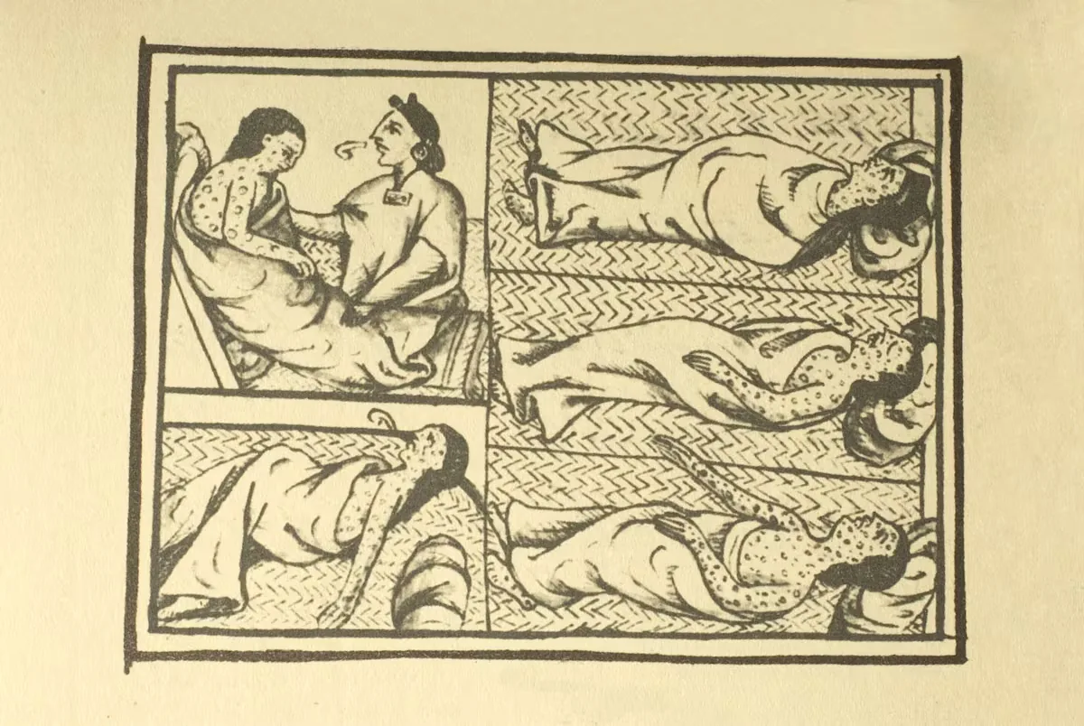 Two 500-year-old mummies confirm that Europeans brought smallpox to America: “It originates from the Old World”