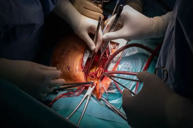 Conchita Barredo, four years after her heart transplant: “I am better than 20 years ago”