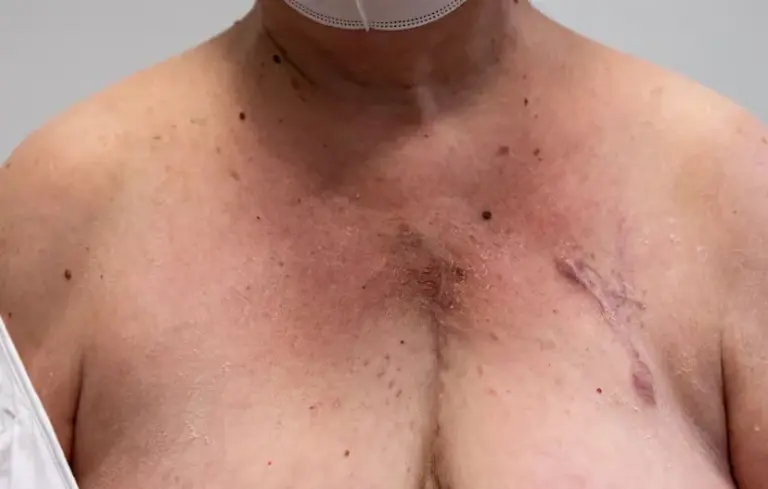 Conchita Barredo, four years after her heart transplant: “I am better than 20 years ago”
