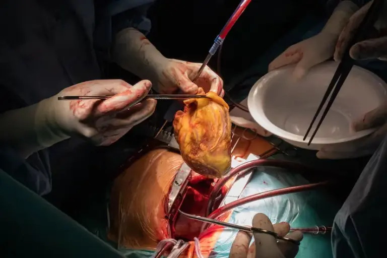 Conchita Barredo, four years after her heart transplant: “I am better than 20 years ago”