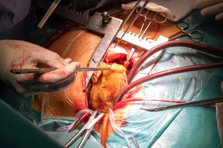 Conchita Barredo, four years after her heart transplant: “I am better than 20 years ago”