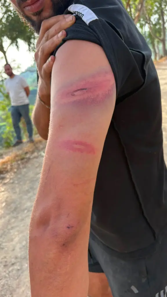 Neighborhood patrols encourage outbreaks of violence against immigrants in Ceuta neighborhoods