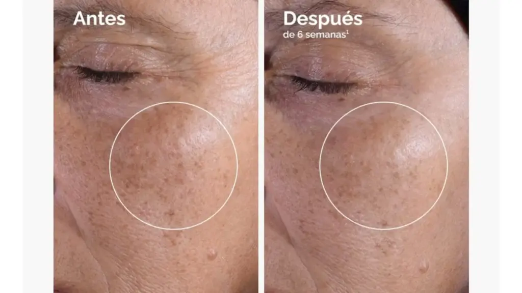 Tónico exfoliante septiembre 26 cuerpo 2