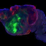 Mice with millions of human neurons in their brains bring us closer to the answer to mental illnesses