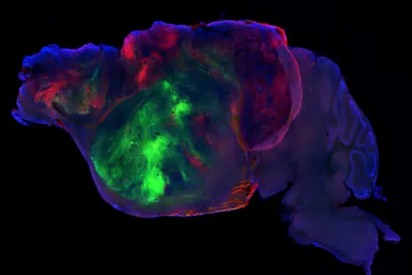 Mice with millions of human neurons in their brains bring us closer to the answer to mental illnesses