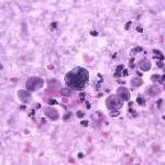 The 'brain-eating' amoeba leaves its first victim in Yucatán: a wakeboard instructor from an artificial lake