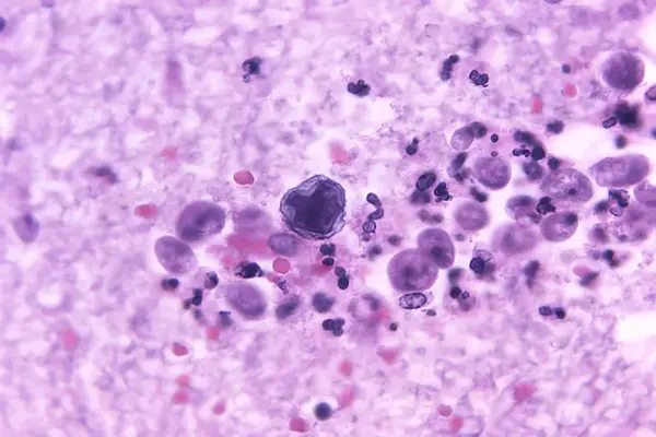 The 'brain-eating' amoeba leaves its first victim in Yucatán: a wakeboard instructor from an artificial lake